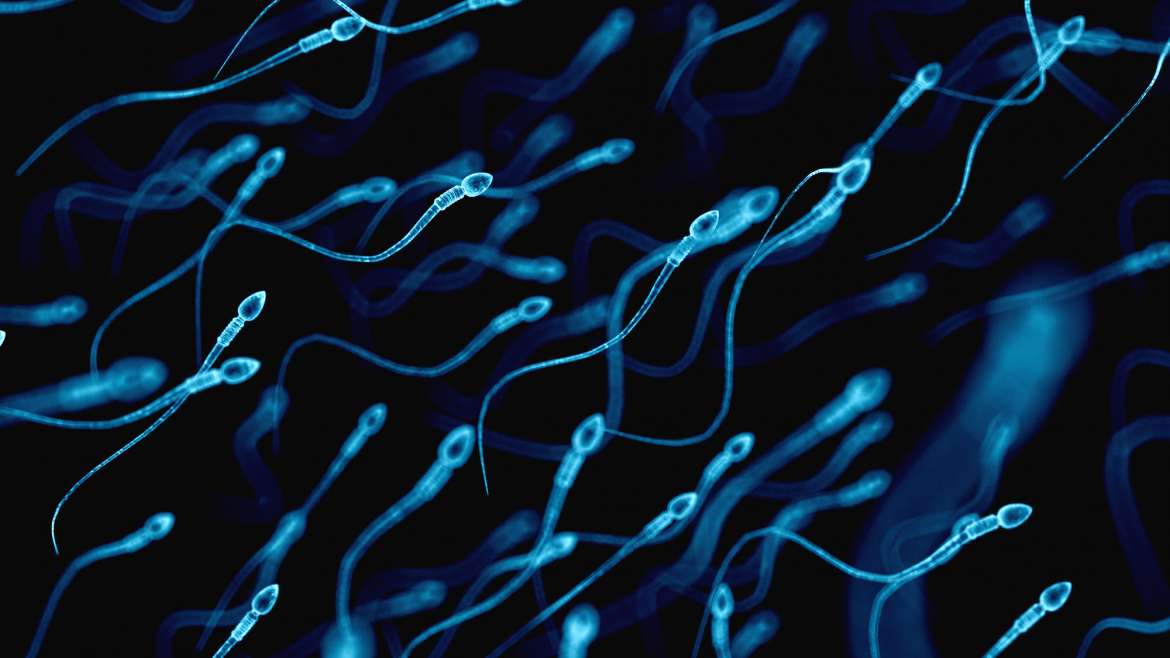 Testikuläre Spermien-Extraktion (TESE)